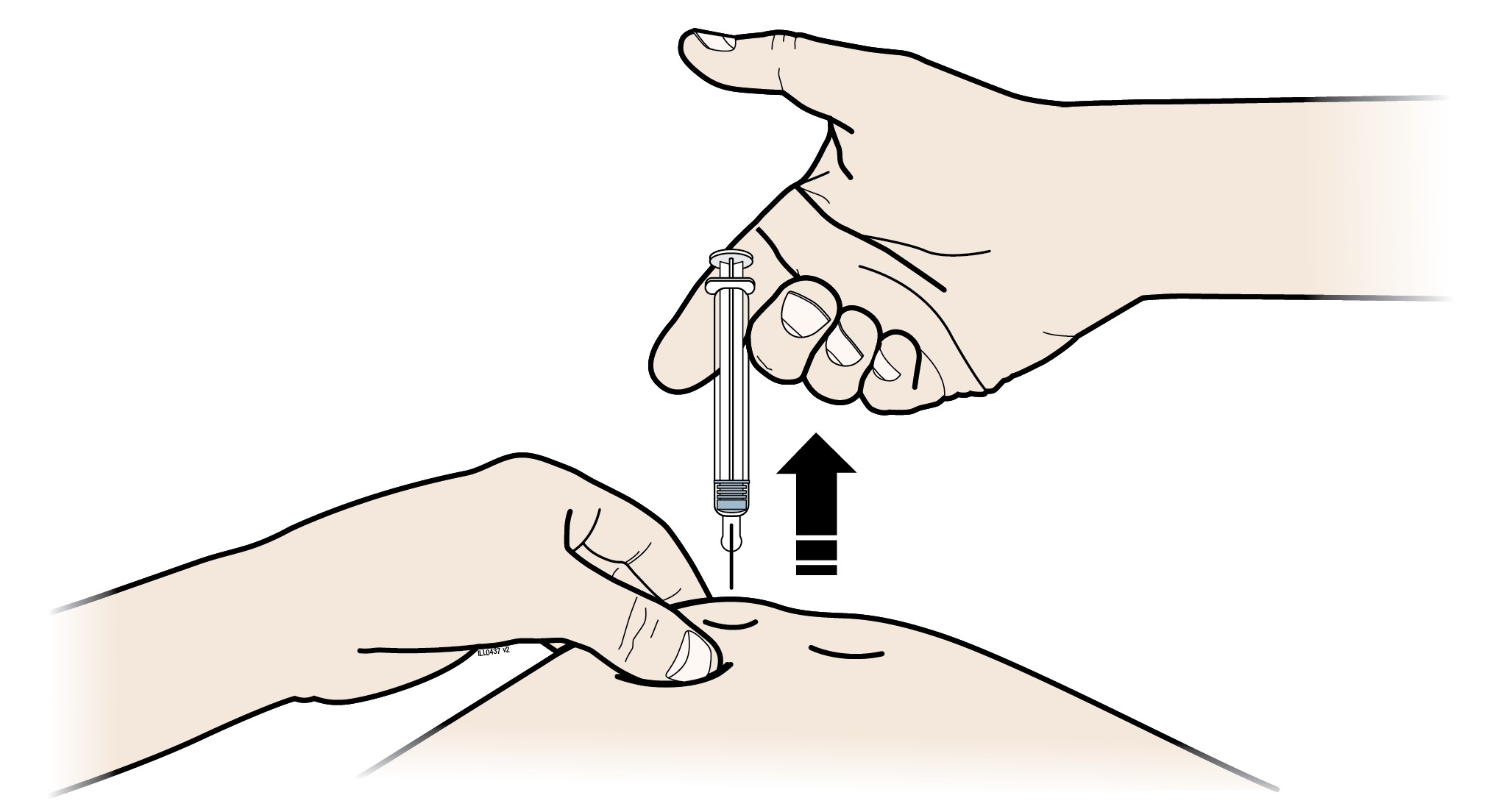 C. LYFT BORT tummen när du är klar och lyft försiktigt bort sprutan från huden.