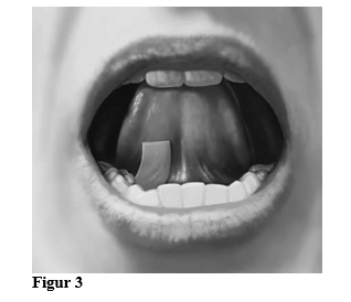 Bilden visar hur man placerar filmen under tungan