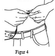 Figur 4 - Ta tag om huden med två fingrar (se till att få minst 2,5 cm mellan fingrarna)