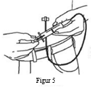 Figur 5 - Anslut en steril spruta till den fyllda administreringsslangen