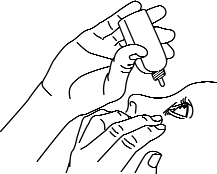4. Vänd flaskan så att spetsen pekar nedåt och tryck försiktigt (figur 2 och 3) tills en (1) droppe kommer i kontakt med ögat enligt läkarens anvisningar. Vidrör inte ögat eller ögonlocken med droppflaskans spets.