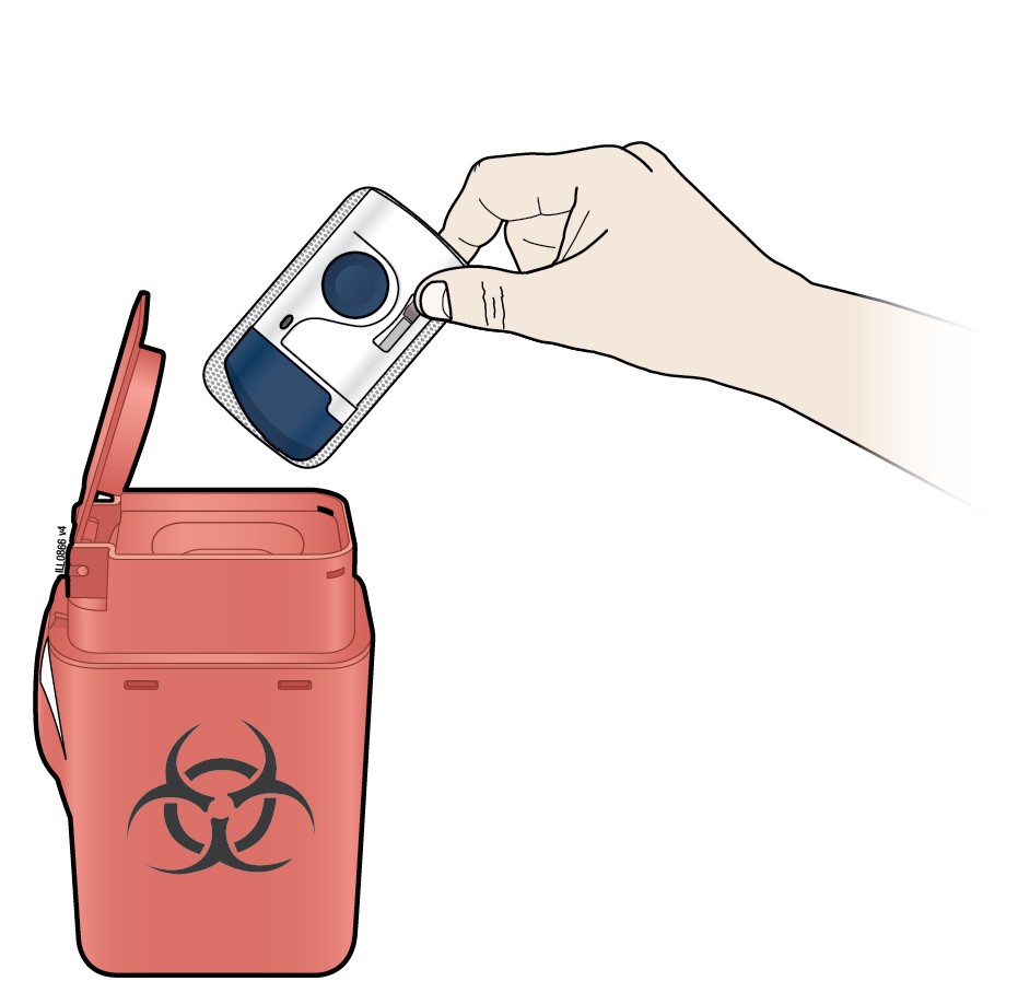 P. Kasta den automatiska doseringspumpen i behållaren för vassa föremål.
