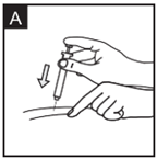 Figur A: Nyp försiktigt ihop huden och injicera enligt instruktionerna