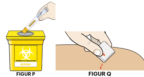 Släng den förfyllda injektionspennan och ta hand om injektionsstället.