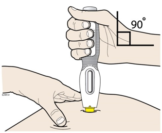 Draget eller nypet ska hållas kvar. Den förfyllda injektionspennans gula säkerhetsskydd ska placeras med den andra handen på området av huden som tidigare rengjorts (”injektionsstället”) i 90° graders vinkel.