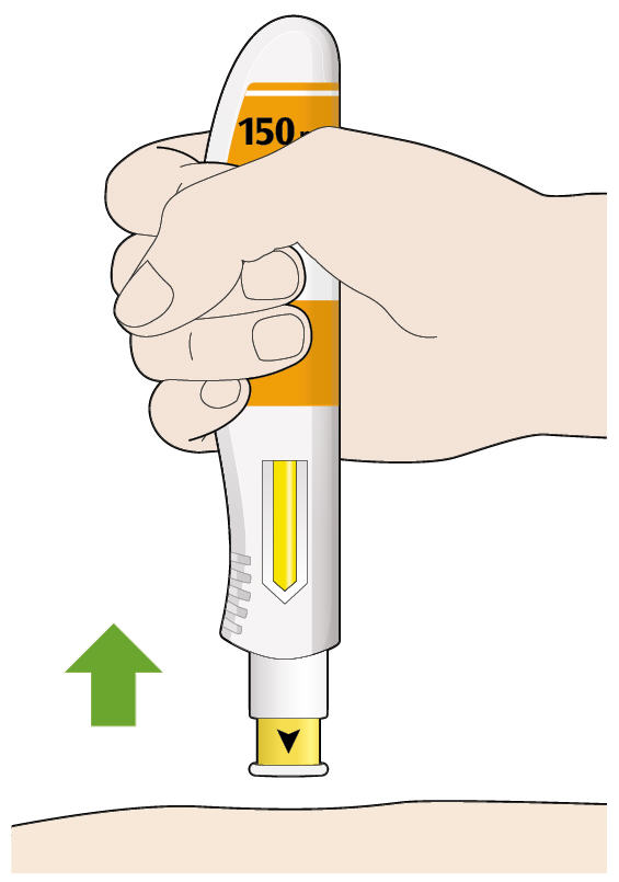 Bilden visar hur du drar ut pennan ur huden