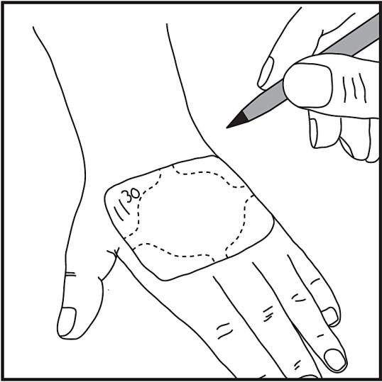 Det är enkelt att skriva tidpunkten när plåstret sattes på huden direkt på plåstret. (En kulspetspenna kan användas för detta ändamål.)